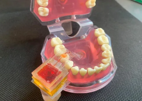 OSU e-Taste - University photograph of e-Taste actuator and mouth interface on a dental cast.