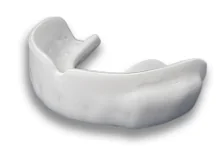 Prevent Biometrics instrumented mouthguard - Prevent manufacturer photograph of an instrumented mouthguard; exact fit variant not specified.